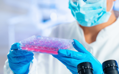 Autoimmune Disease Symptoms Can Be Treated With Stem Cells
